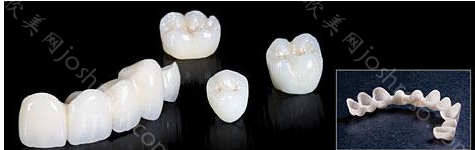 全瓷牙的种类及价格公布，仔细对比1千和3千的牙冠有啥区别