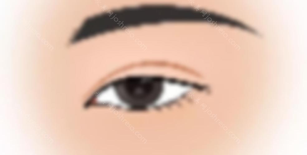 的双眼皮术前照