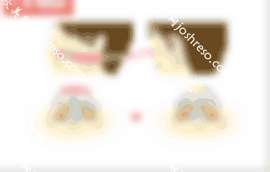 的假体垫鼻基底术前照