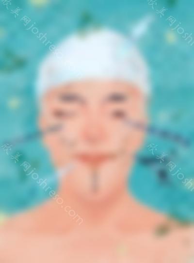 的耳软骨复合隆鼻术后照