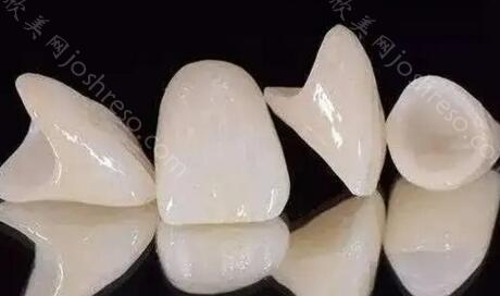 全瓷牙品牌十大排名？选择质量好的全瓷牙来保护口腔健康！