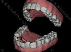 正常咬合牙齿模型图，牙齿咬合正常应该什么样？