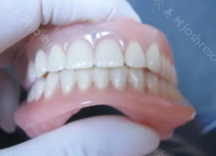 北京海淀区的牙科收费标准;包含各种牙科项目