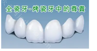 天津市口腔医院收费价格表：全面了解种植牙、牙齿矫正等费用
