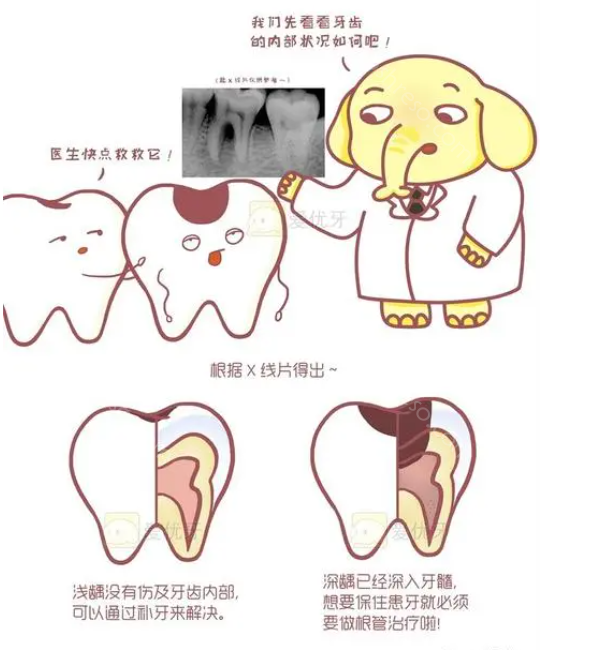好后悔拔了三个烂牙根：烂牙根修复的方法