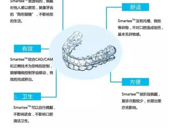 深圳牙齿矫正多少钱?看罗湖区透明牙套价格