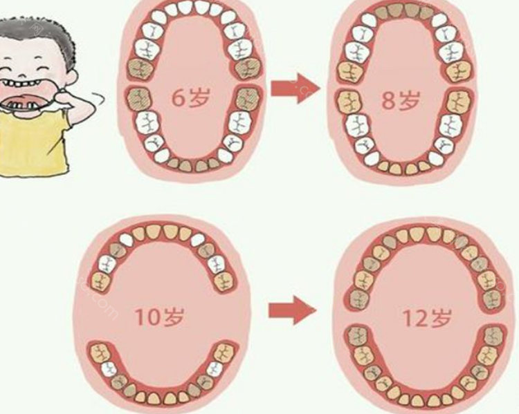 小孩换牙齿的顺序图，以及换牙期间应该注意什么?