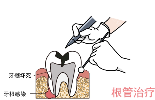 成都洗牙齿哪家医院好?这几家榜上有名