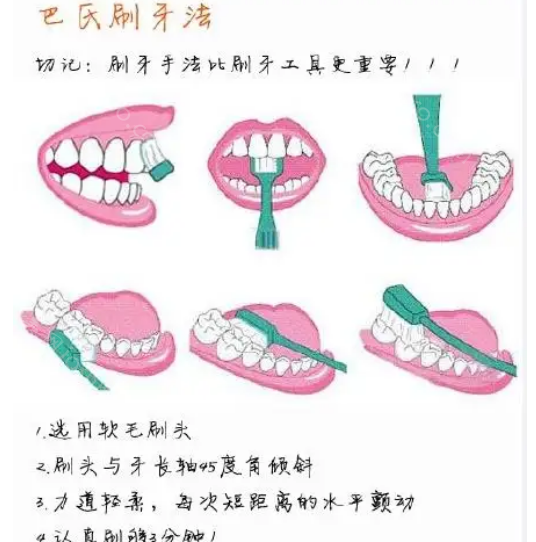 改良巴氏刷牙法的高清动图