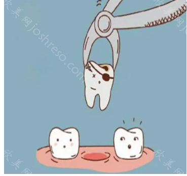 拔了四颗牙脸瘪了，专业牙医告诉你怎么避免
