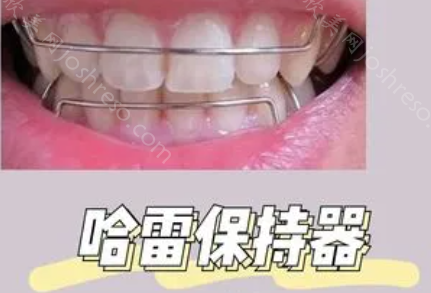 云南省口腔医院收费标准：种植牙、牙齿矫正等价格