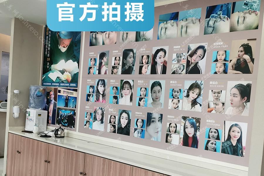 深圳自体脂肪填充面部医院排名-价格表更新！六家网友推介医美盘点~