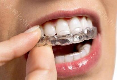 北京隐形牙套矫正价格多少？北京看正规牙科收费多少钱？