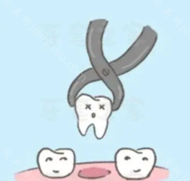 沈阳一颗牙齿根管治疗多少钱?看沈阳的牙科收费价目表