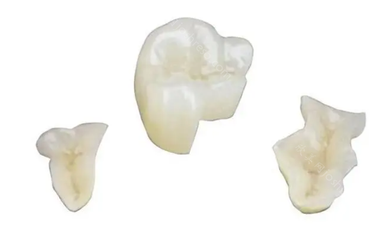 德伦口腔医院价目表2023：含广州、佛山等地种植牙、正畸的价格