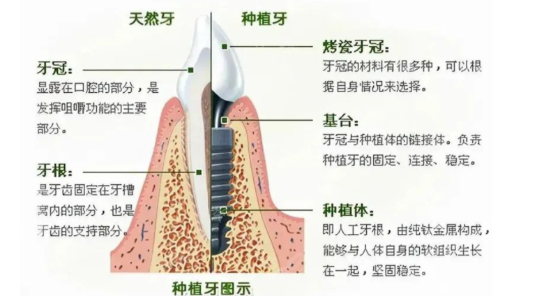 北京美冠塔口腔怎么样?正规吗?中老年专科口腔医院，值得信赖