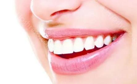 深圳牙科医院哪个性价比高？深圳矫正牙一般需要多少钱？