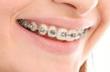 深圳益齿佳口腔怎么样?医院正规靠谱