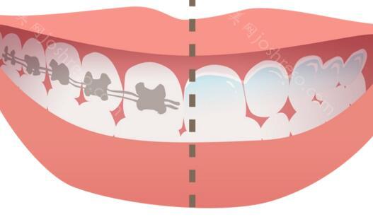 合肥牙齿矫正器多少钱？盘点合肥哪家牙科矫正牙齿比较靠谱？