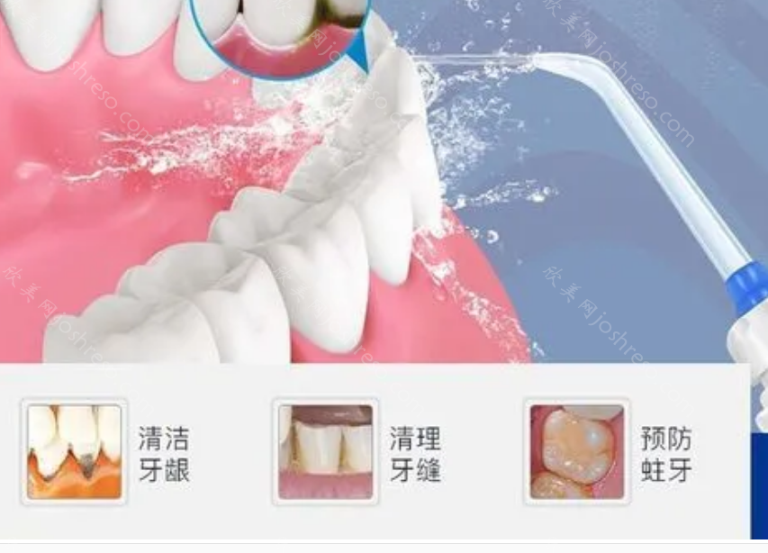 北京爵冠口腔医院收费标准：在这里种植牙和牙齿矫正并不贵