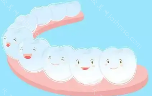 牙套的种类及价格表大全：看完你就知道选择哪种牙齿矫正器了