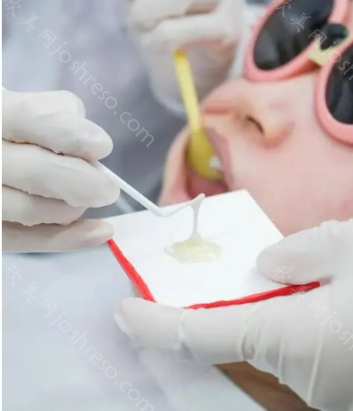 资深牙医告诉你，牙齿涂氟多少钱一次，涂氟有副作用吗
