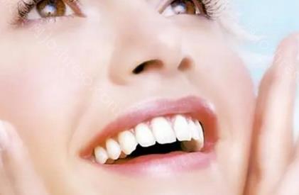 武汉牙齿贴面需要多少钱？武汉哪些口腔医院贴面修复技术好？