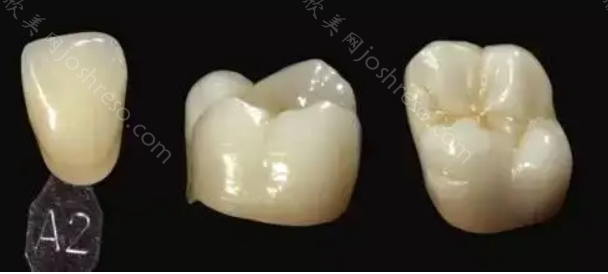 北京全瓷牙冠多少钱一颗?价格表2023，包含国产和进口的二氧化锆牙套