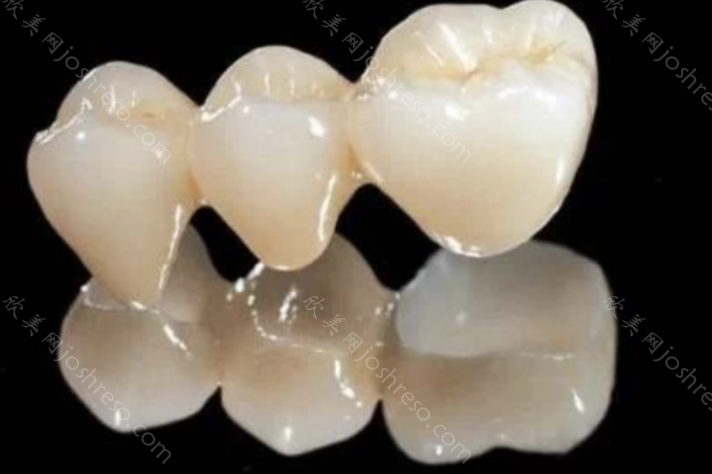 北京全瓷牙冠多少钱一颗?价格表2023，包含国产和进口的二氧化锆牙套