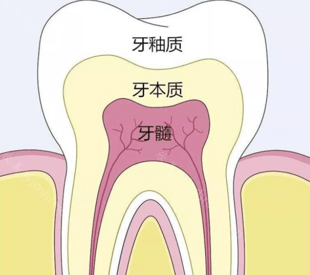 牙釉质可以慢慢修复吗?牙釉质掉了怎么修复?