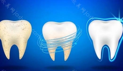 昆明全瓷牙套一颗多少钱？昆明国产和进口的牙冠价格差很多吗？