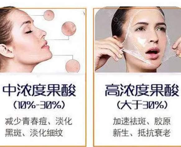 济宁果酸焕肤多少钱一次?1500到2500之间都有