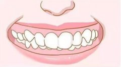 沈阳隐形牙齿矫正价格多少钱？沈阳哪里矫正牙齿比较好？