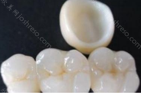 牙冠制作过程图解：让你全面了解制作全瓷牙过程