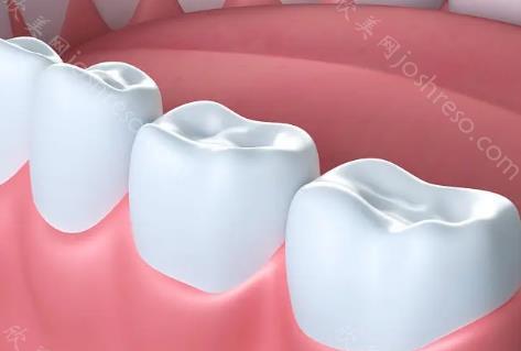 右侧六号牙缺失可以矫正智齿代替吗?智齿前移代替6号牙费用!