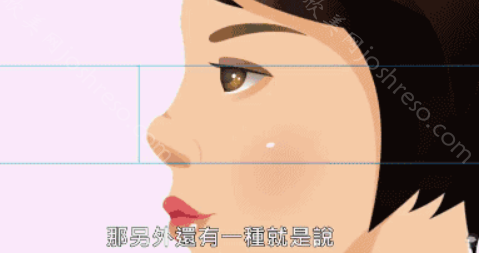 南京艺星隆鼻技术怎么样?看朱刚强医生技术一流
