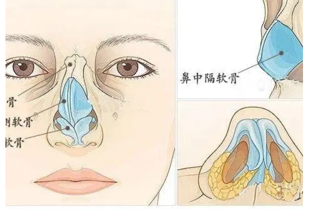 武汉艺星隆鼻技术怎么样?看哪位医生隆鼻技术厉害?