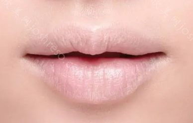 唇部整形术风险大吗？该如何降低风险？