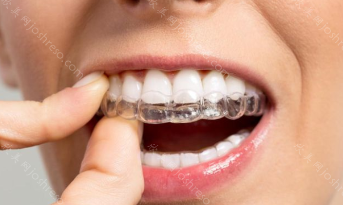 牙齿矫正的佳年龄是在儿童期和青少年期！