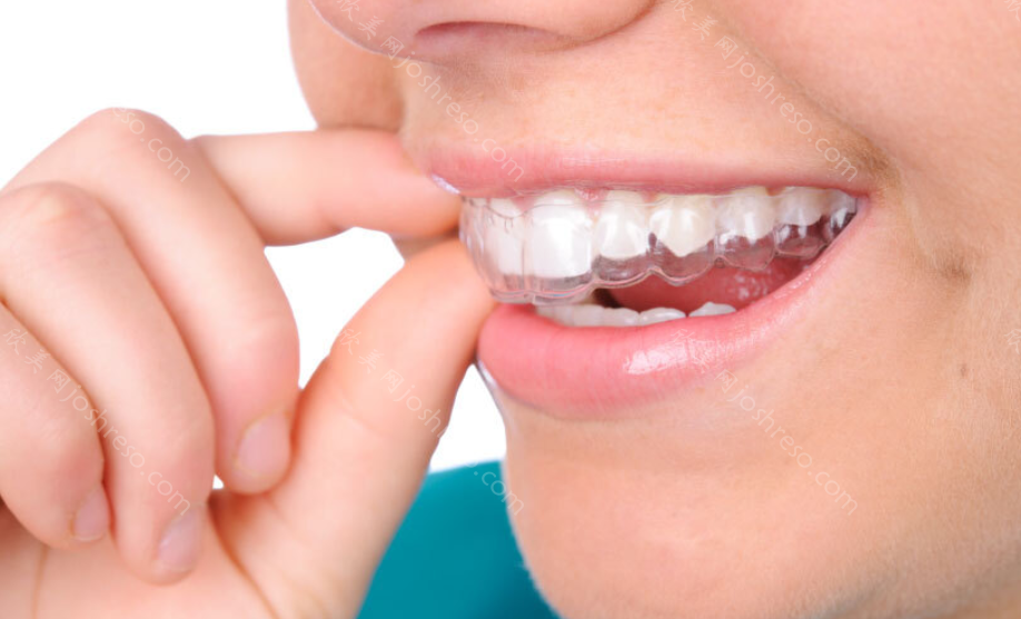 牙齿矫正中颊廊是哪个部位呢？颊廊在牙齿矫正中的作用
