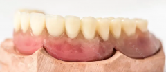 牙齿美容修复方式有几种？美容烤瓷牙,牙齿贴面修复,牙齿矫正修复,牙齿美白修