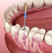 牙医故意把牙磨到漏神经，如何避免牙医故意把牙磨到漏神经？