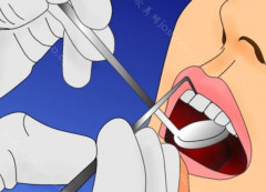 牙齿缺失导致的脸歪还能恢复吗？牙齿缺失的影响，牙齿缺失的治疗方法