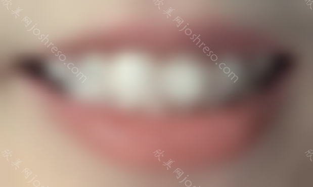 成都[牙齿矫正]如何选择专业的整牙医生？成都整牙费用怎么样？