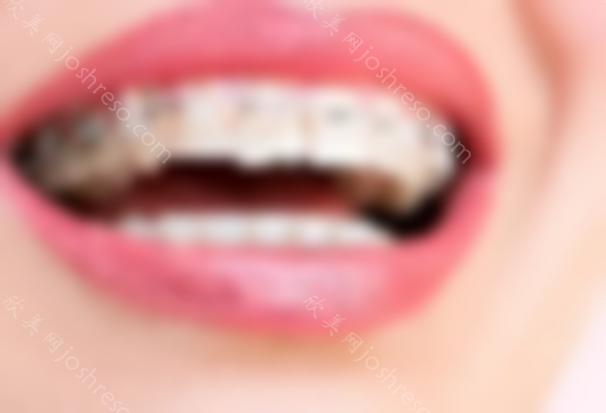 成都牙齿矫正哪家医院好？整牙价格多少？