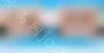 成都牙齿正畸怎么样？一正畸案例分享过程！
