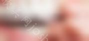 成都正畸好多钱？牙齿复杂程度，牙套等都会影响价格！