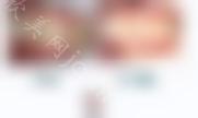 成都正畸好多钱？牙齿复杂程度，牙套等都会影响价格！