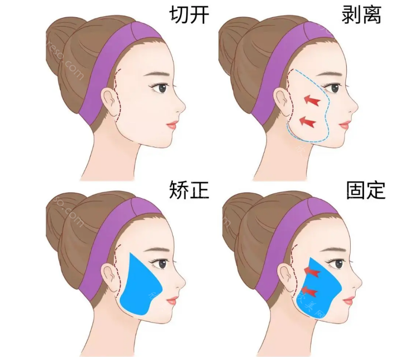 长春铭医整形价格表上线了，有需要的赶紧收藏!