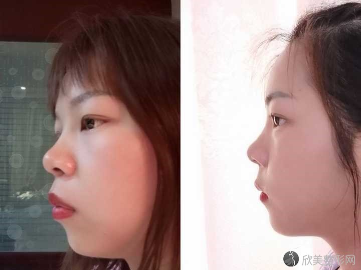 厦门玛恩皮肤美容医院的口碑很不错，拥有良好的评价和优秀的医师实力。